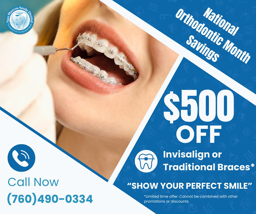 San Marcos Smile Dental | Digital Impressions, Dental Cleanings and Full Mouth Reconstruction