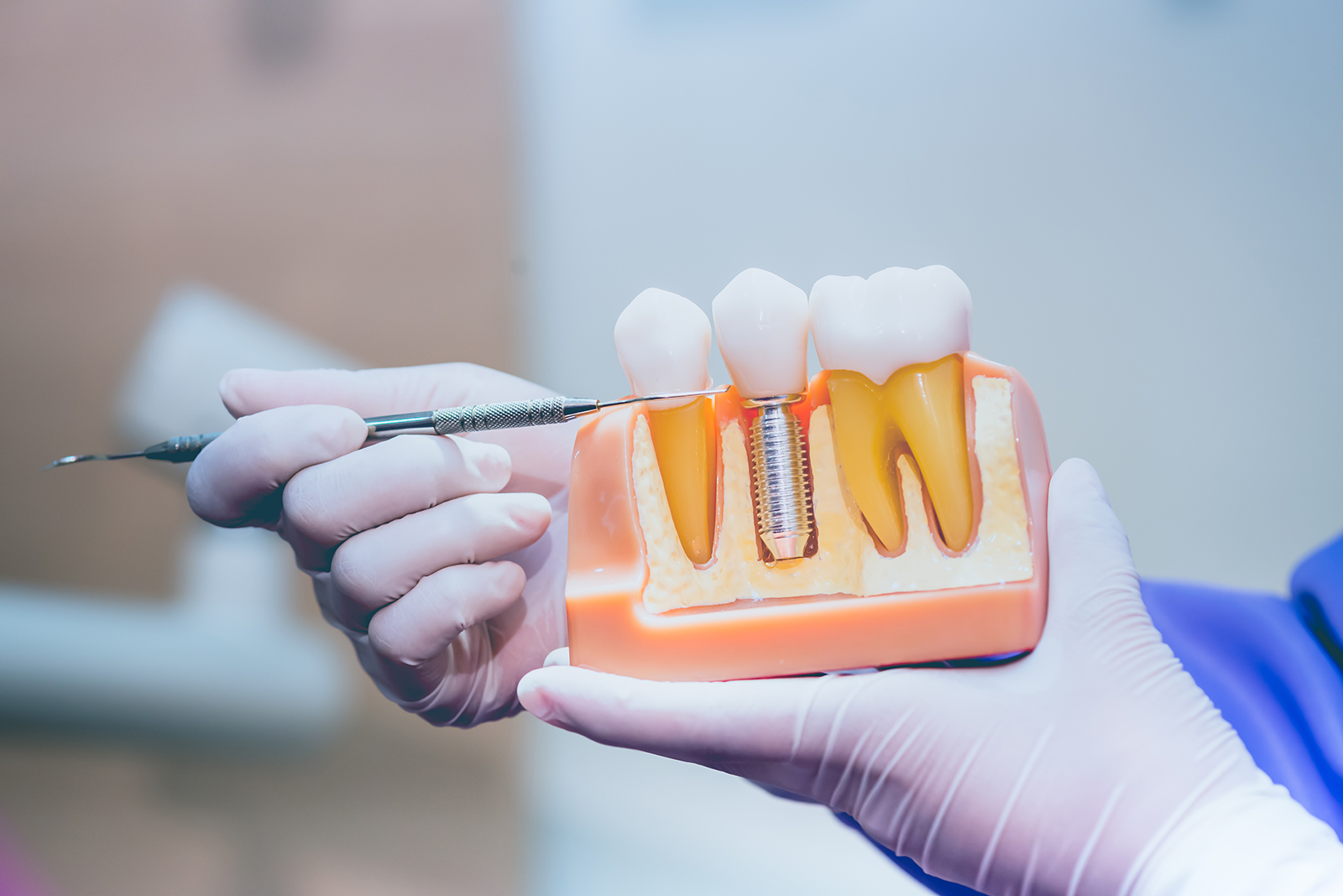 San Marcos Smile Dental | Implant Restorations, Oral Cancer Screening and Digital Impressions