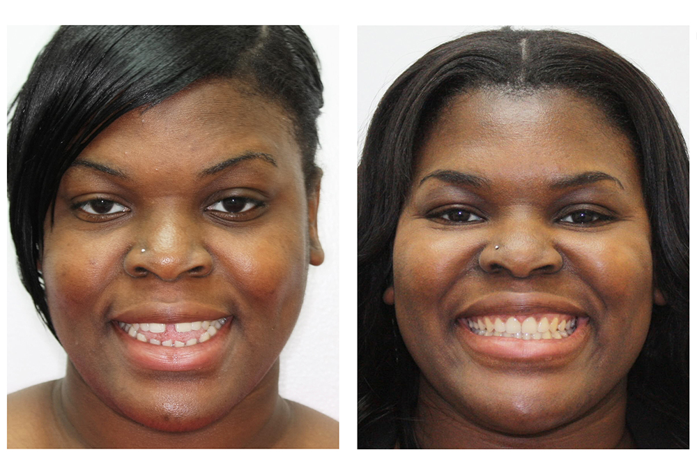 San Marcos Smile Dental