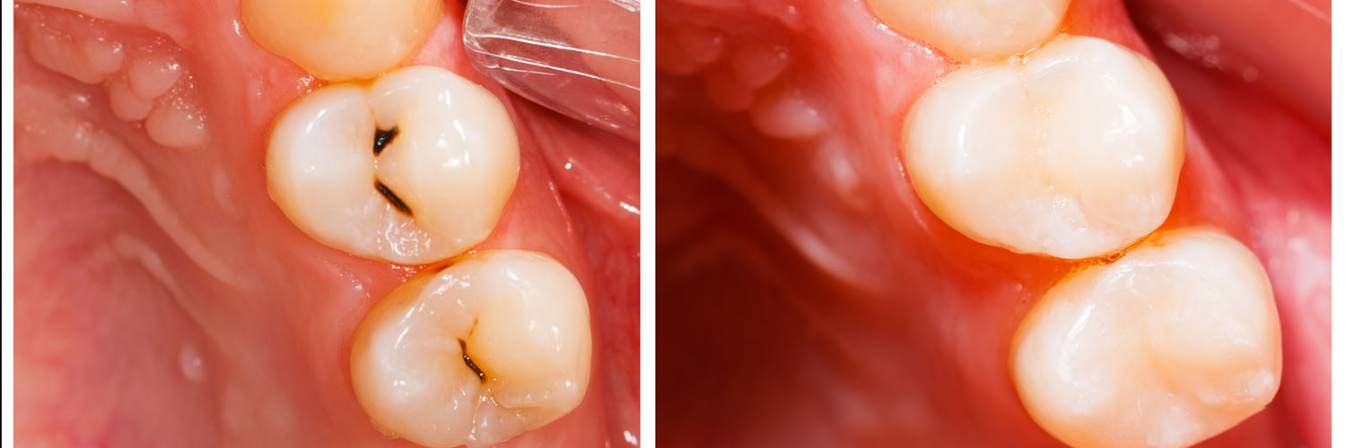 San Marcos Smile Dental
