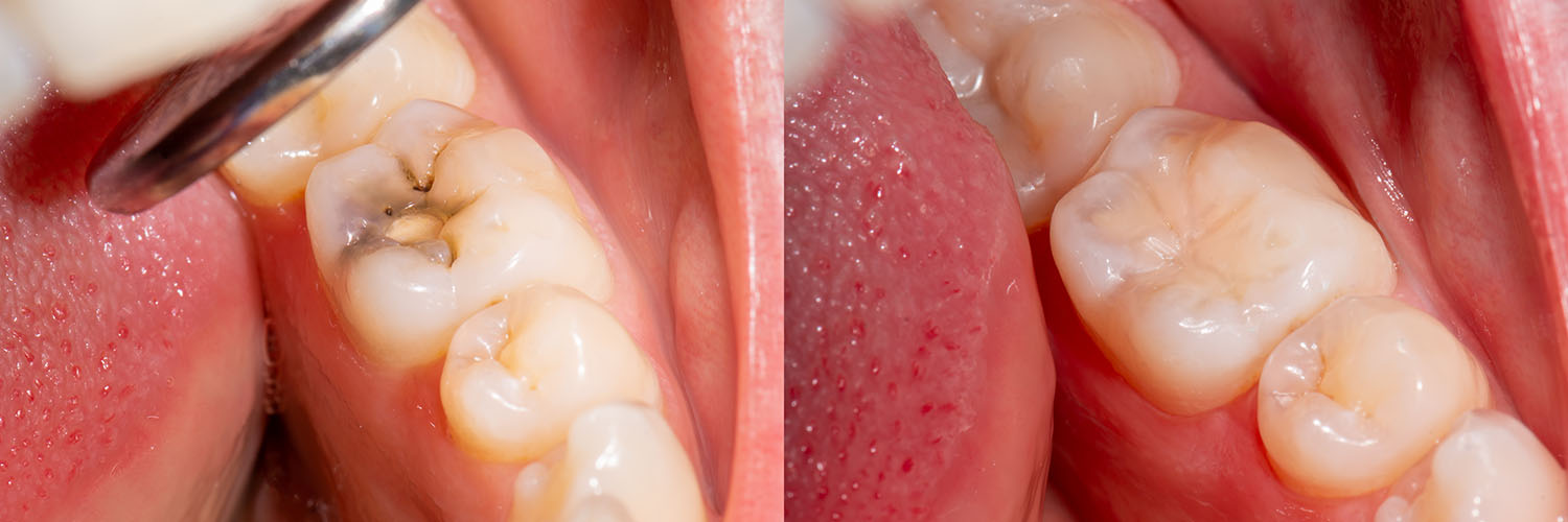 San Marcos Smile Dental