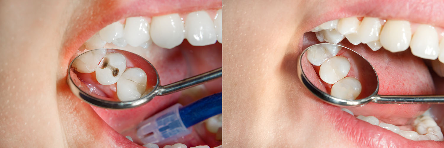 San Marcos Smile Dental